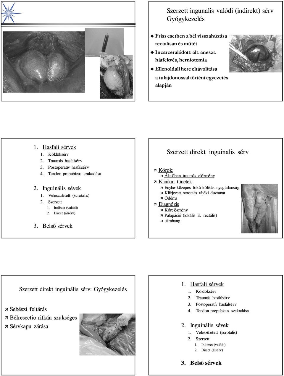 Hasfali sérvek Szerzett direkt inguinalis sérv Kórok: Általában traumás előzmény Klinikai tünetek Enyhe-közepes fokú kólikás nyugtalanság Kifejezett