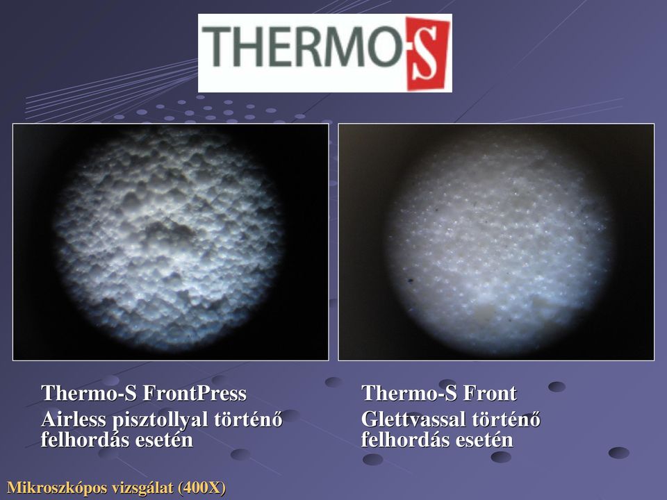 Thermo-S Front Glettvassal történő