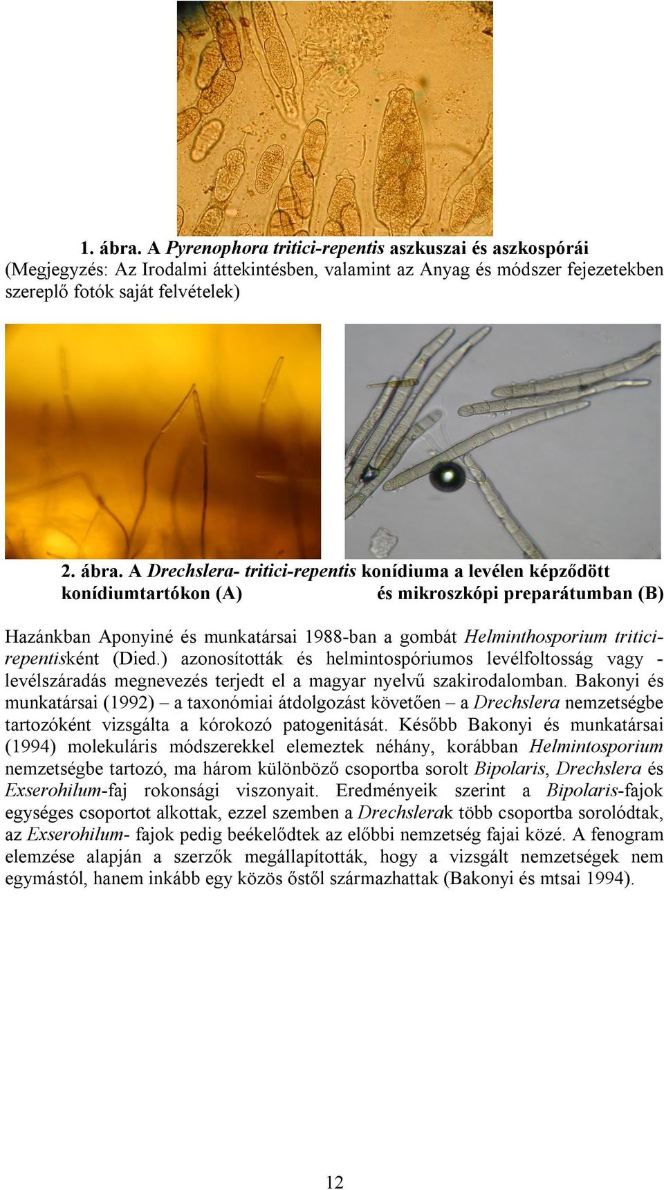 A Drechslera- tritici-repentis konídiuma a levélen képződött konídiumtartókon (A) és mikroszkópi preparátumban (B) Hazánkban Aponyiné és munkatársai 1988-ban a gombát Helminthosporium