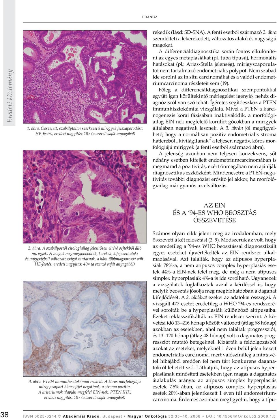 : Arias-Stella jelenség), mirigyszaporulatot nem tartalmazó endometrialis polypot. Nem szabad ide sorolni az in situ carcinomákat és a valódi endometriumcarcinoma részleteit sem (19).