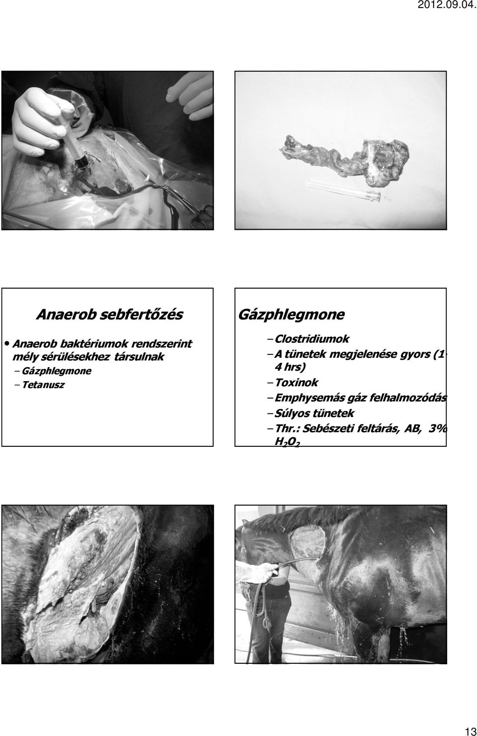 Clostridiumok A A tünetek megjelenése gyors (1-4 hrs) Toxinok