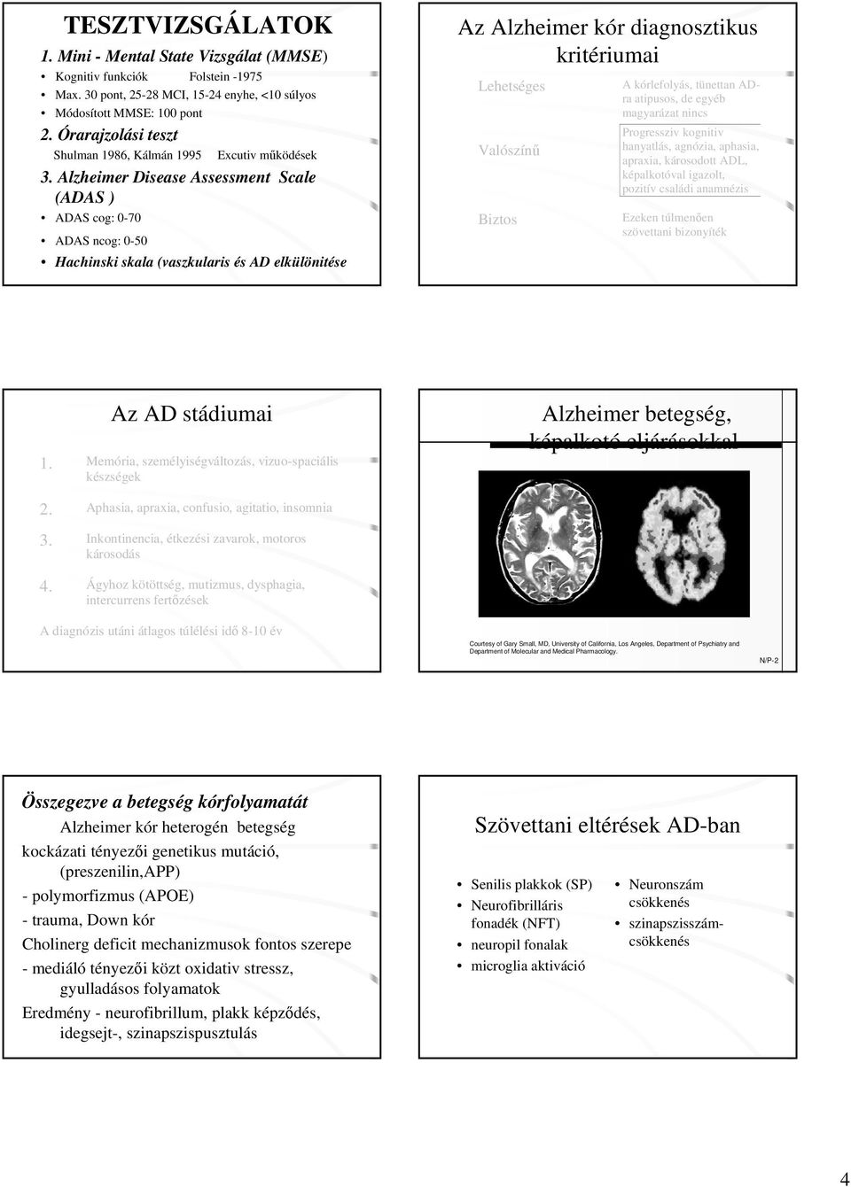 Alzheimer Disease Assessment Scale (ADAS ) ADAS cog: 0-70 ADAS ncog: 0-50 Hachinski skala (vaszkularis és AD elkülönitése Az Alzheimer kór diagnosztikus kritériumai Lehetséges Valószínű Biztos A