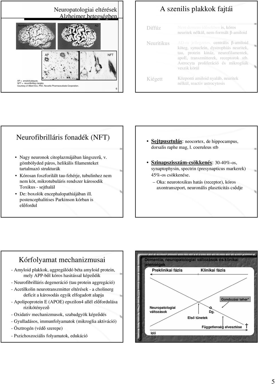 Astrocyta proliferáció és mikrogliák veszik körül AP = amyloid plaques. NFT = neurofibrillary tangles. Courtesy of Albert Enz, PhD, Novartis Pharmaceuticals Corporation.