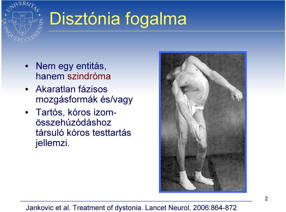 izomösszehúzódáshoz társuló kóros testtartás jellemzi.