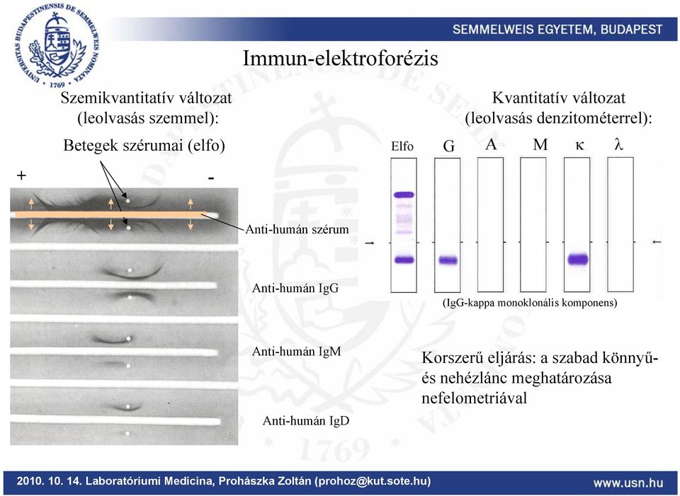 λ Anti-humán szérum Anti-humán IgG (IgG-kappa monoklonális komponens) Anti-humán