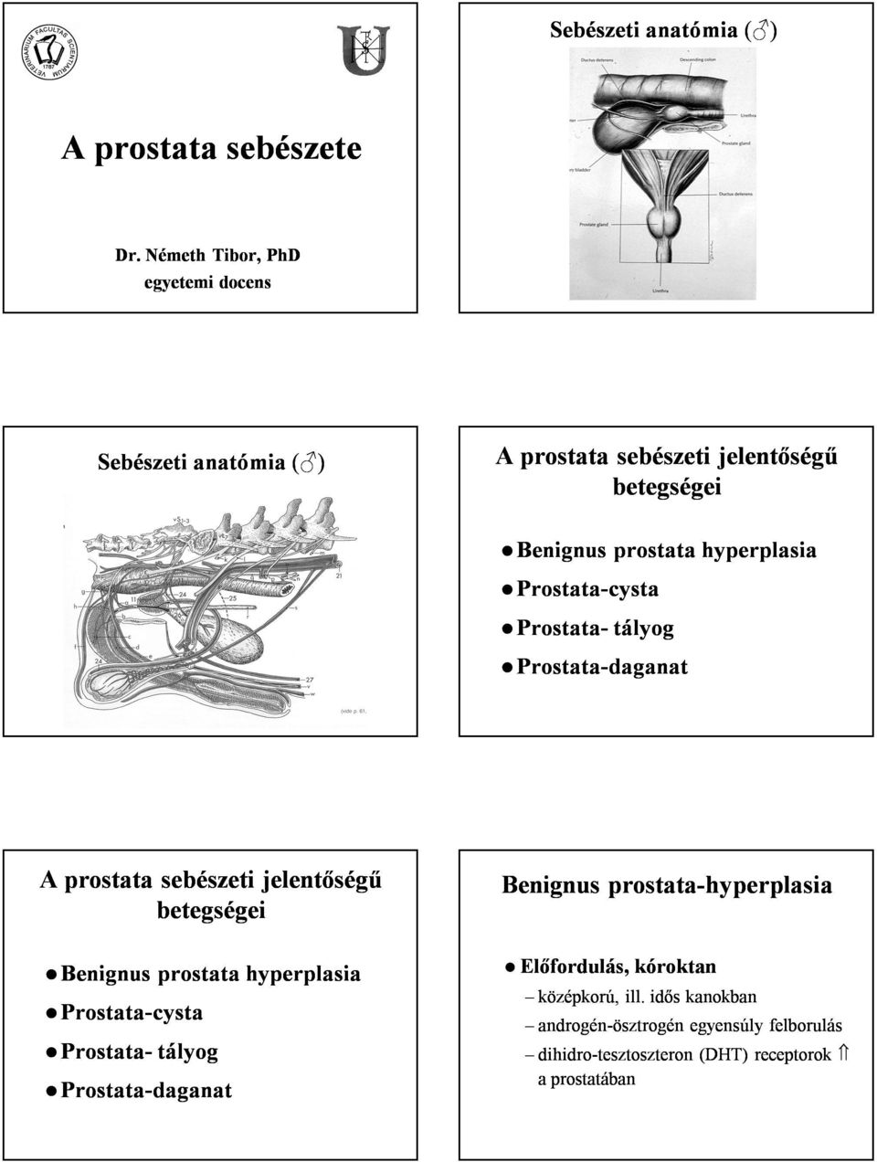 hyperplasia -cysta - tályog -daganat A prostata sebészeti jelentőségű betegségei Benignus prostata hyperplasia -cysta -