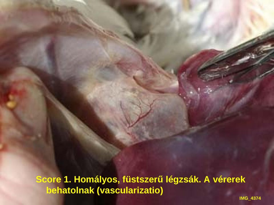 légzsák.