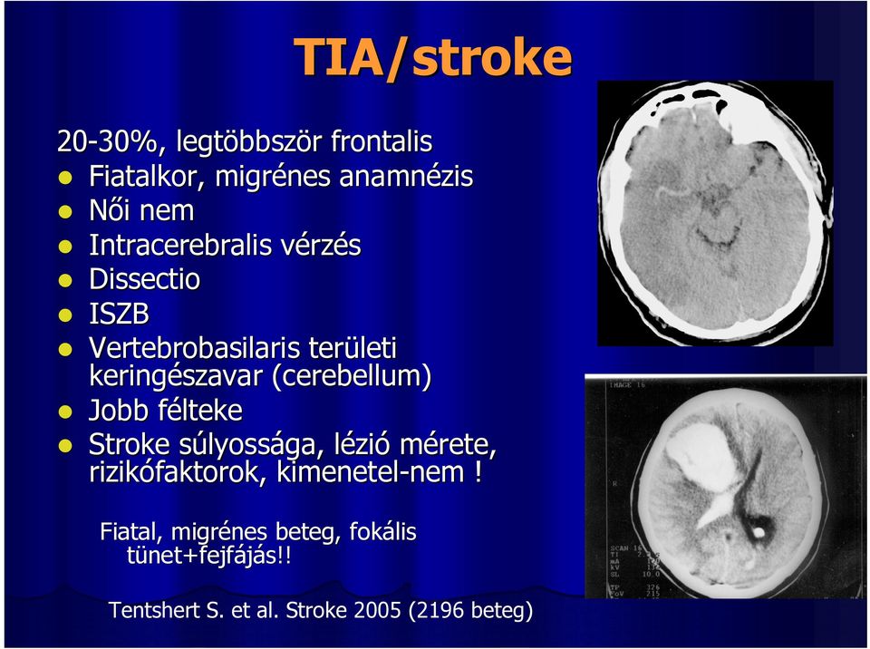 cerebellum) Jobb féltekef Stroke súlyossága, lézió mérete, rizikófaktorok, kimenetel-nem