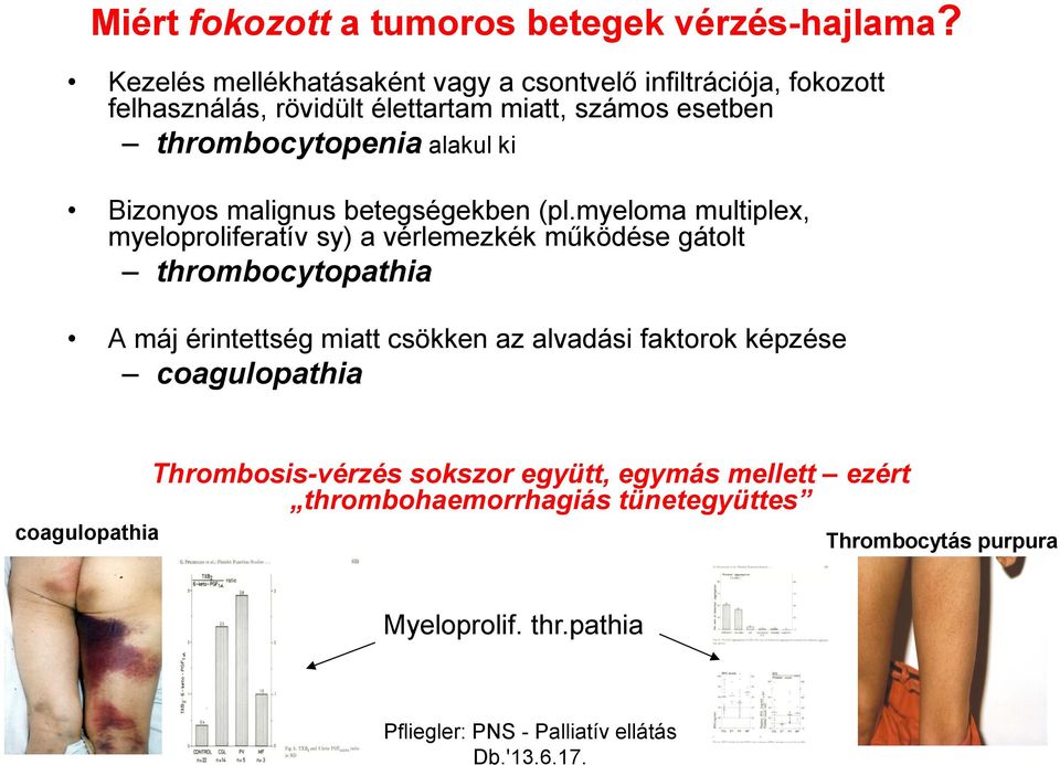 thrombocytopenia alakul ki Bizonyos malignus betegségekben (pl.