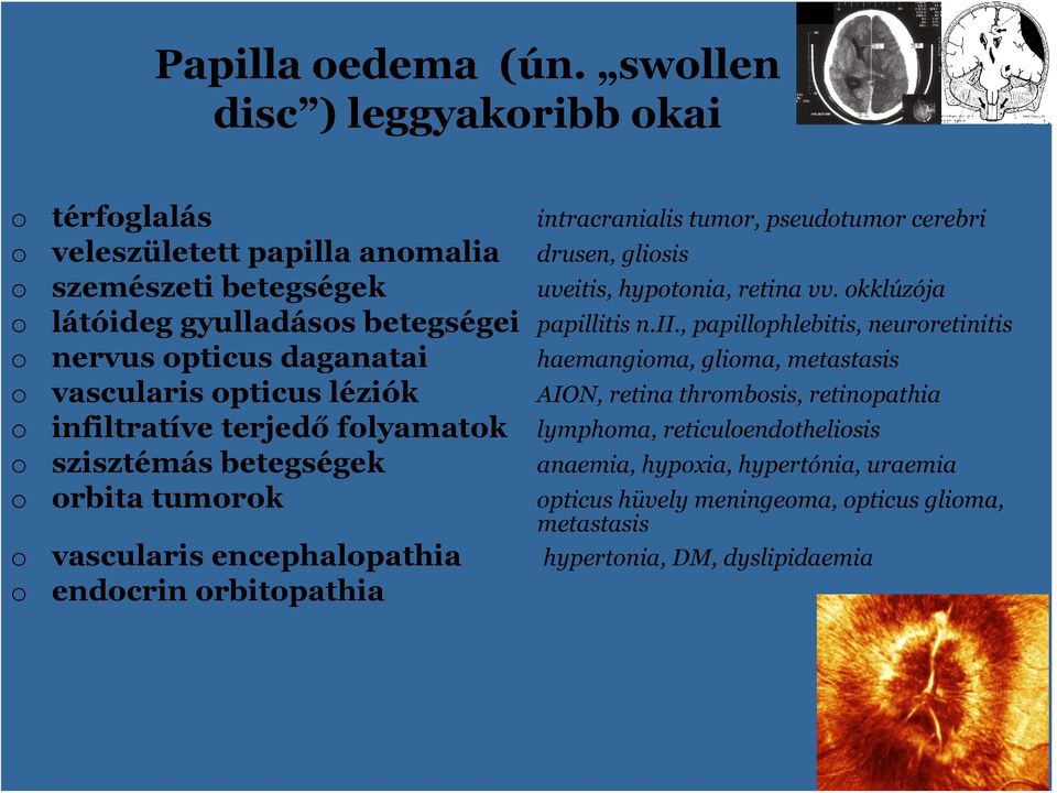 hyptnia, retina vv. kklúzója látóideg gyulladáss betegségei papillitis n.ii.