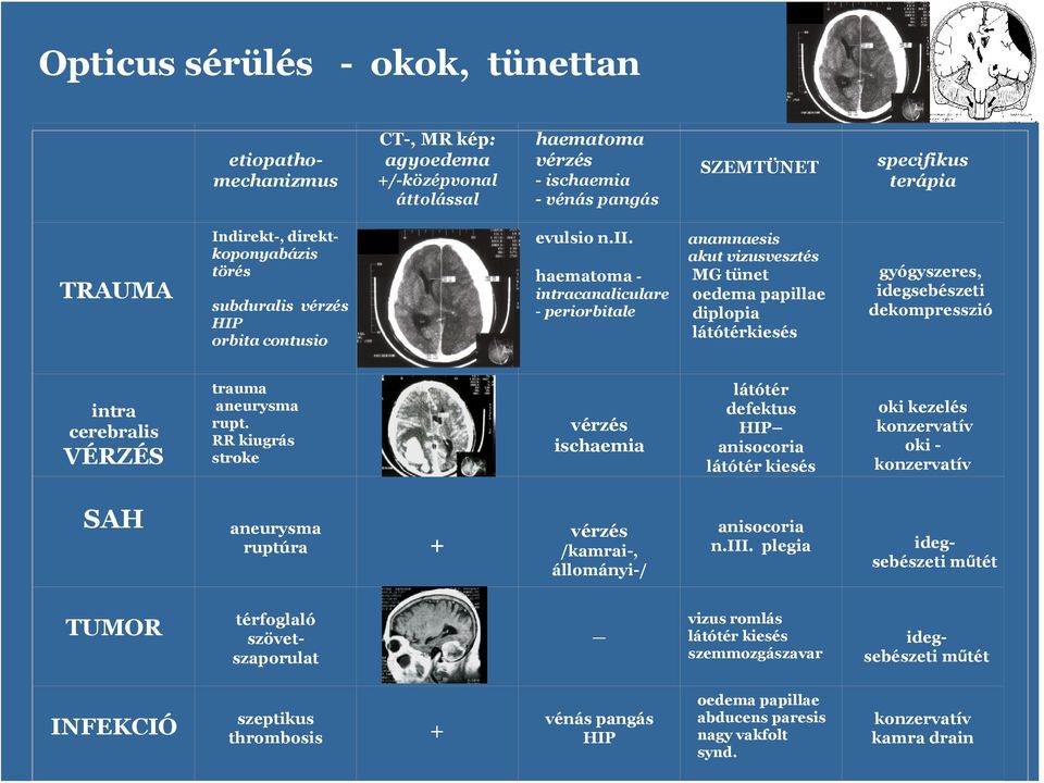 haematma - intracanaliculare - perirbitale anamnaesis akut vizusvesztés MG tünet edema papillae diplpia látótérkiesés gyógyszeres, idegsebészeti dekmpresszió intra cerebralis VÉRZÉS trauma aneurysma