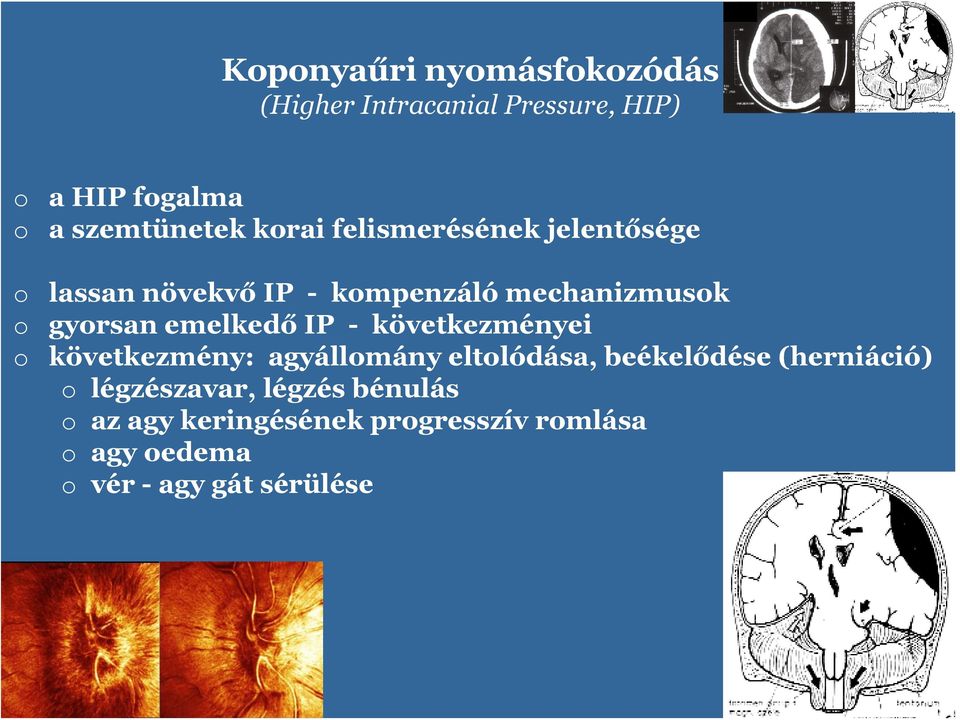 - következményei következmény: agyállmány eltlódása, beékelődése (herniáció)