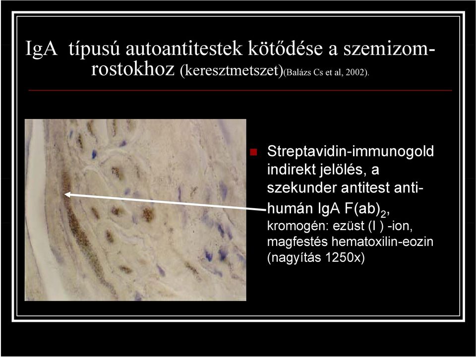 Streptavidin-immunogold indirekt jelölés, a szekunder antitest