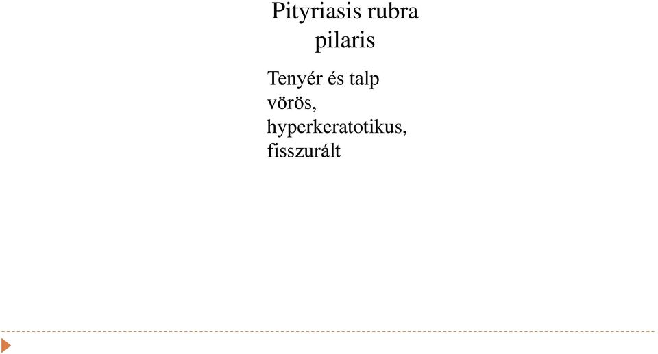 talp vörös,