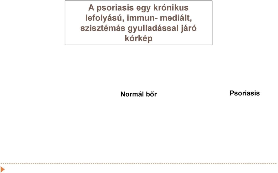 szisztémás gyulladással