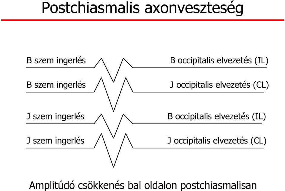 ingerlés J szem ingerlés B occipitalis elvezetés (IL) J