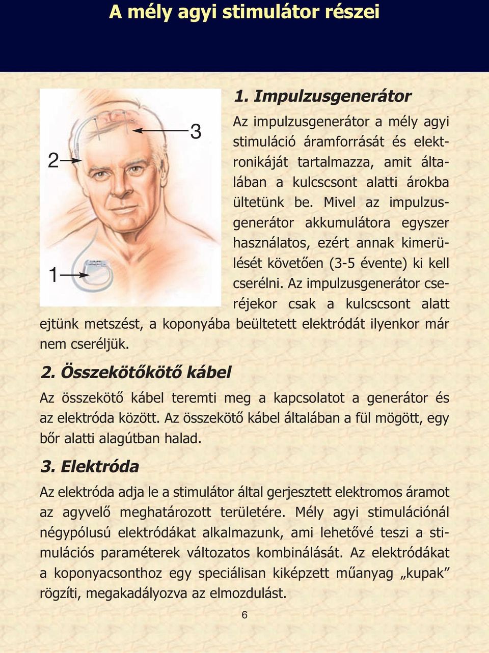 Az impulzusgenerátor cseréjekor csak a kulcscsont alatt ejtünk metszést, a koponyába beültetett elektródát ilyenkor már nem cseréljük. 2.