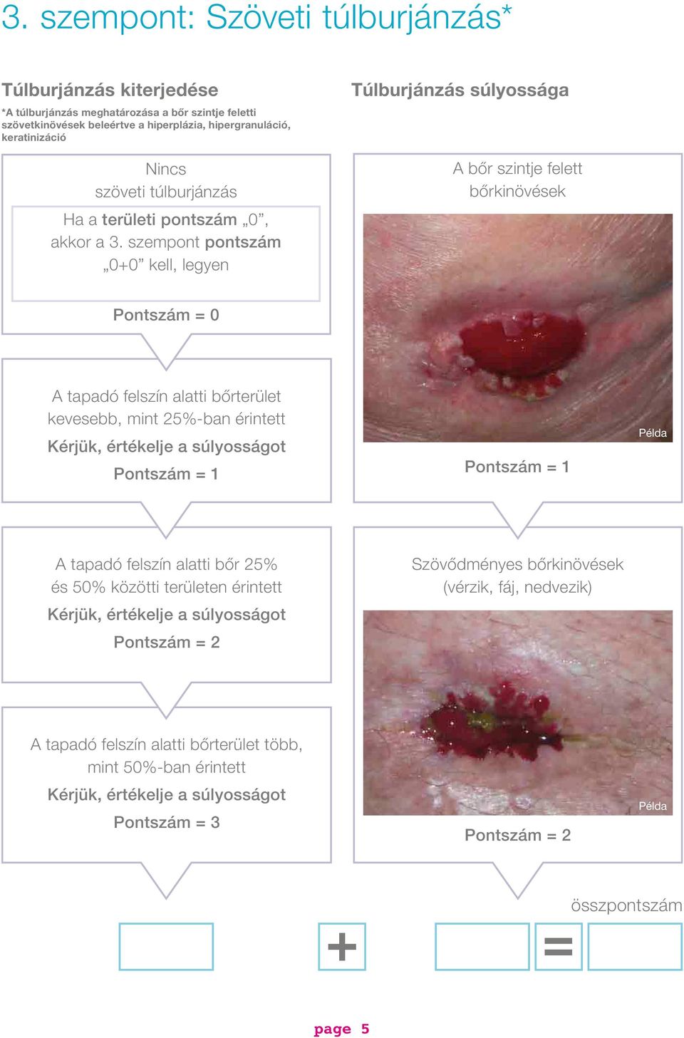 szempont pontszám 0+0 kell, legyen Túlburjánzás súlyossága A bőr szintje felett bőrkinövések Pontszám = 0 A tapadó felszín alatti bőrterület kevesebb, mint 25%-ban érintett