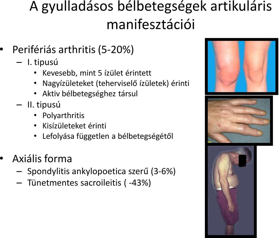 bélbetegséghez társul II.