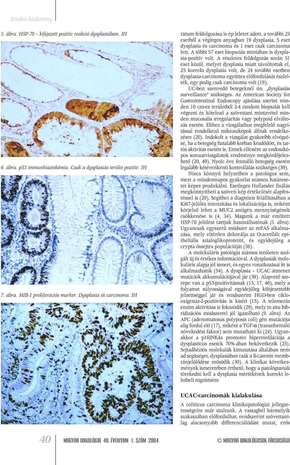A többi 57 eset biopsziás mintában is dysplasia-pozitív volt.