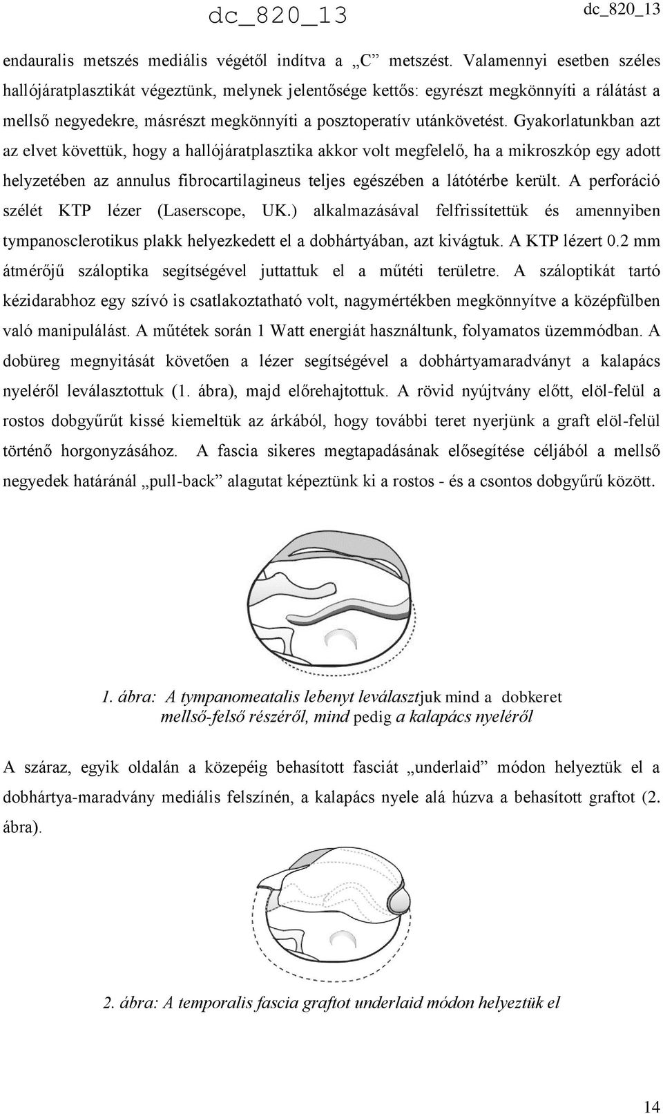 Gyakorlatunkban azt az elvet követtük, hogy a hallójáratplasztika akkor volt megfelelő, ha a mikroszkóp egy adott helyzetében az annulus fibrocartilagineus teljes egészében a látótérbe került.