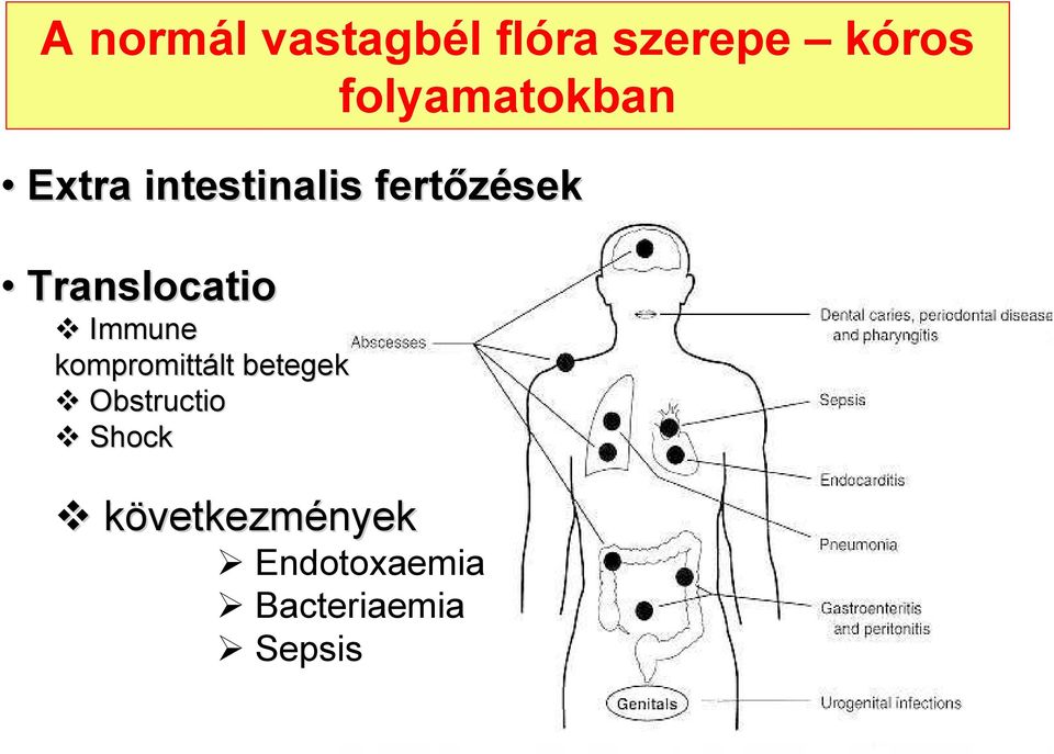 Translocatio Immune kompromittált betegek
