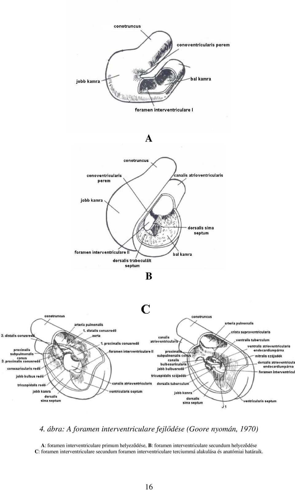 foramen interventriculare primum helyeződése, B: foramen