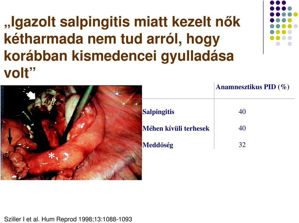 Anamnesztikus PID (%) Salpingitis 40 Méhen kívüli