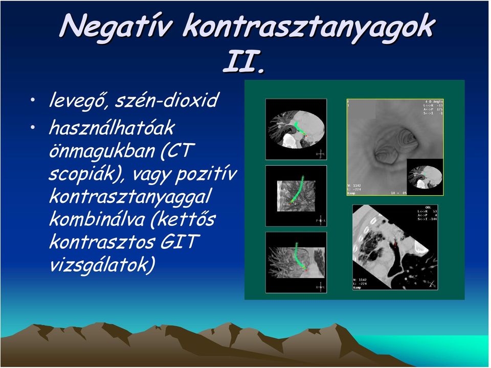 scopiák), vagy pozitív kontrasztanyaggal