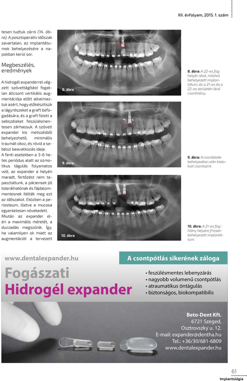 graft felett a sebszéleket feszülésmentesen zárhassuk. A szöveti expander kis metszésből behelyezhető, minimális traumát okoz, és rövid a sebészi beavatkozás ideje.