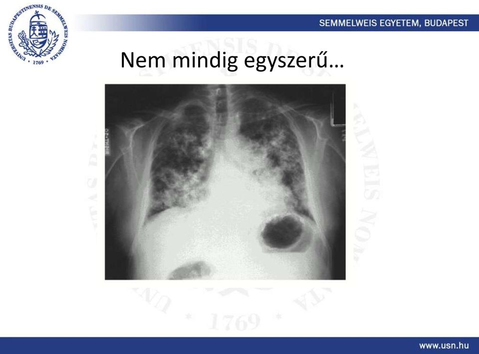 egyszerű