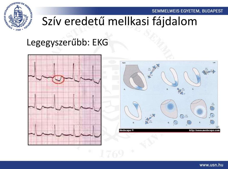 fájdalom
