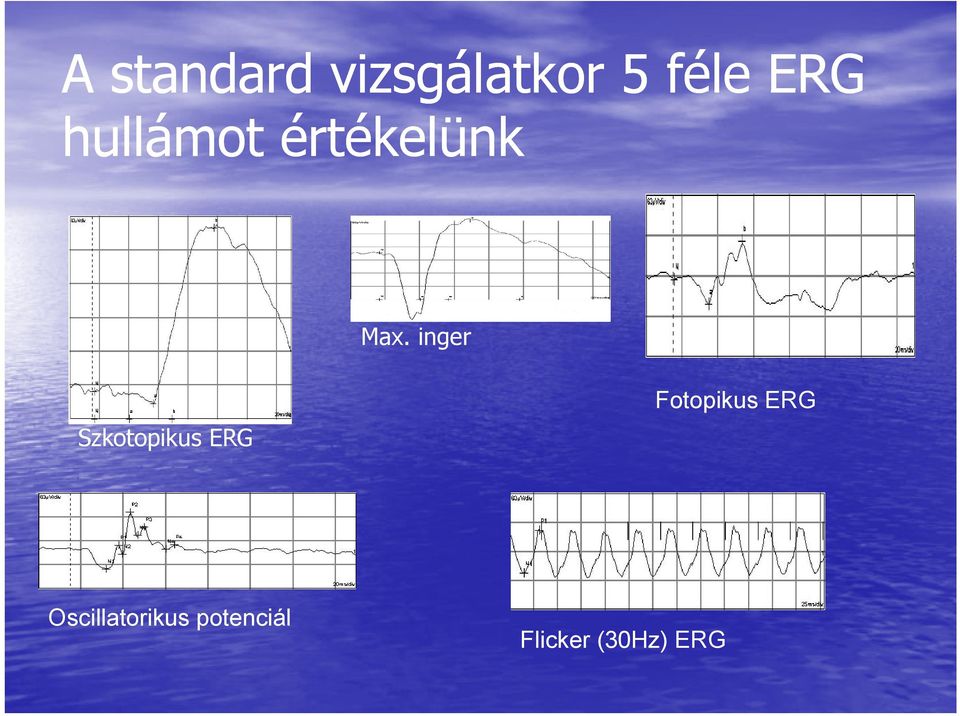 inger Szkotopikus ERG Fotopikus