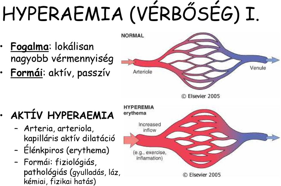 passzív AKTÍV HYPERAEMIA Arteria, arteriola, kapilláris aktív