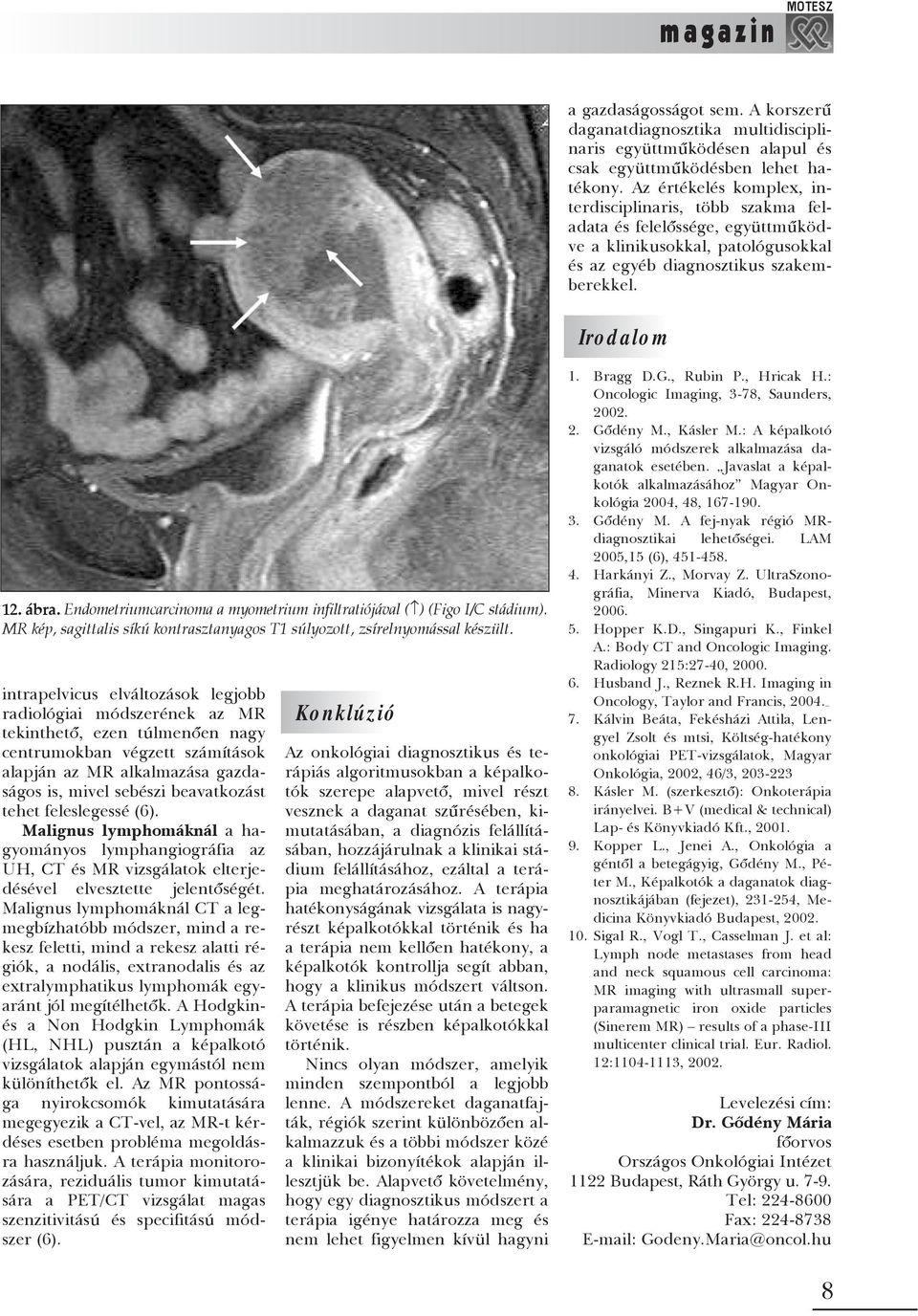 Endometriumcarcinoma a myometrium infiltratiójával ( ) (Figo I/C stádium). MR kép, sagittalis síkú kontrasztanyagos T1 súlyozott, zsírelnyomással készült.