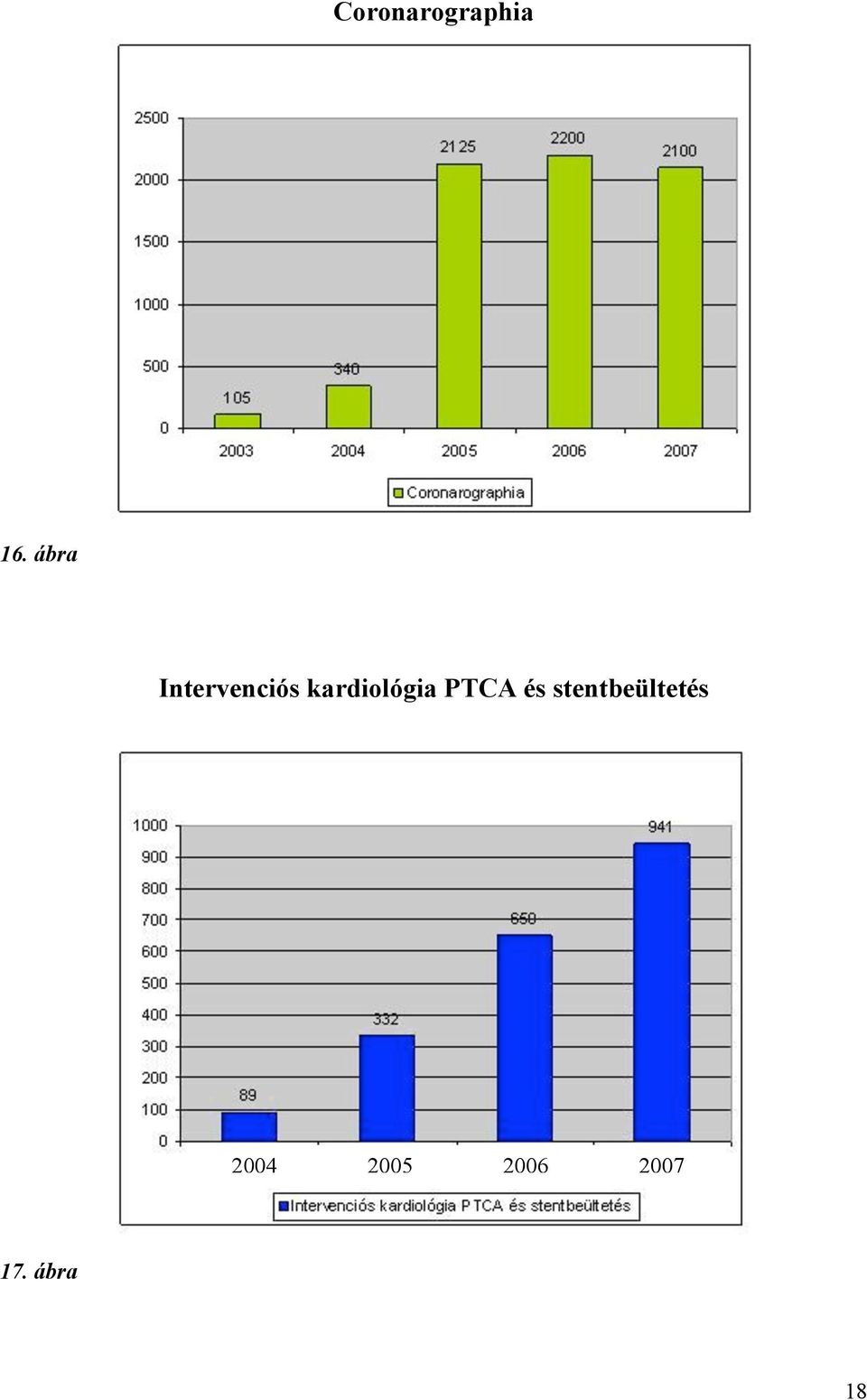 kardiológia PTCA és