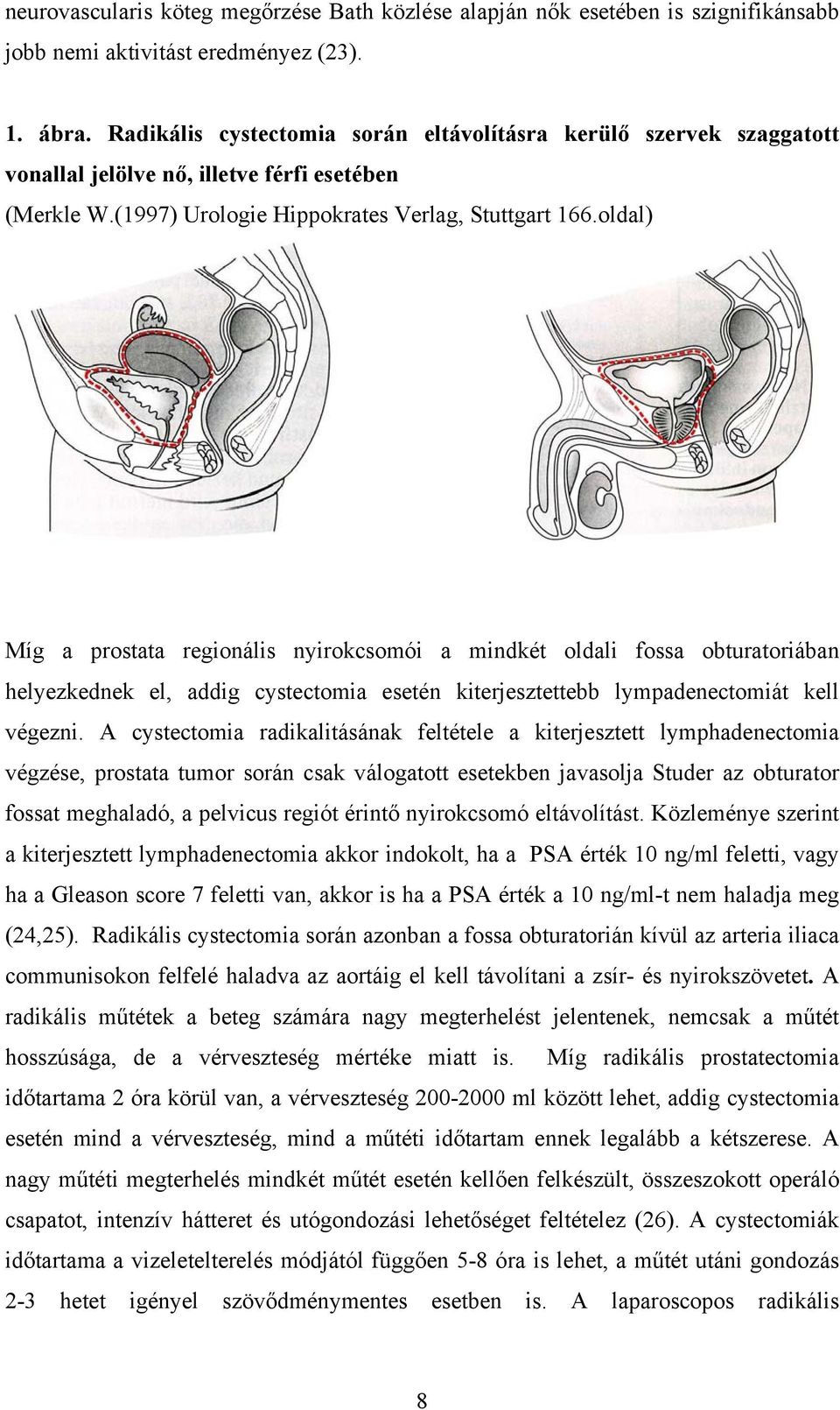 oldal) Míg a prostata regionális nyirokcsomói a mindkét oldali fossa obturatoriában helyezkednek el, addig cystectomia esetén kiterjesztettebb lympadenectomiát kell végezni.