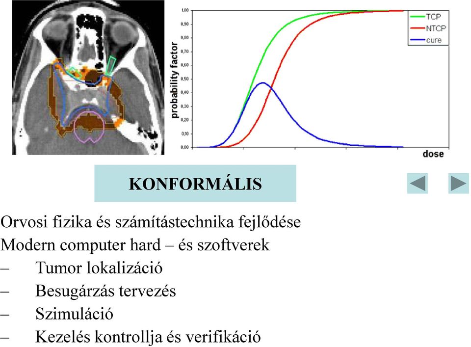 hard és szoftverek Tumor lokalizáció