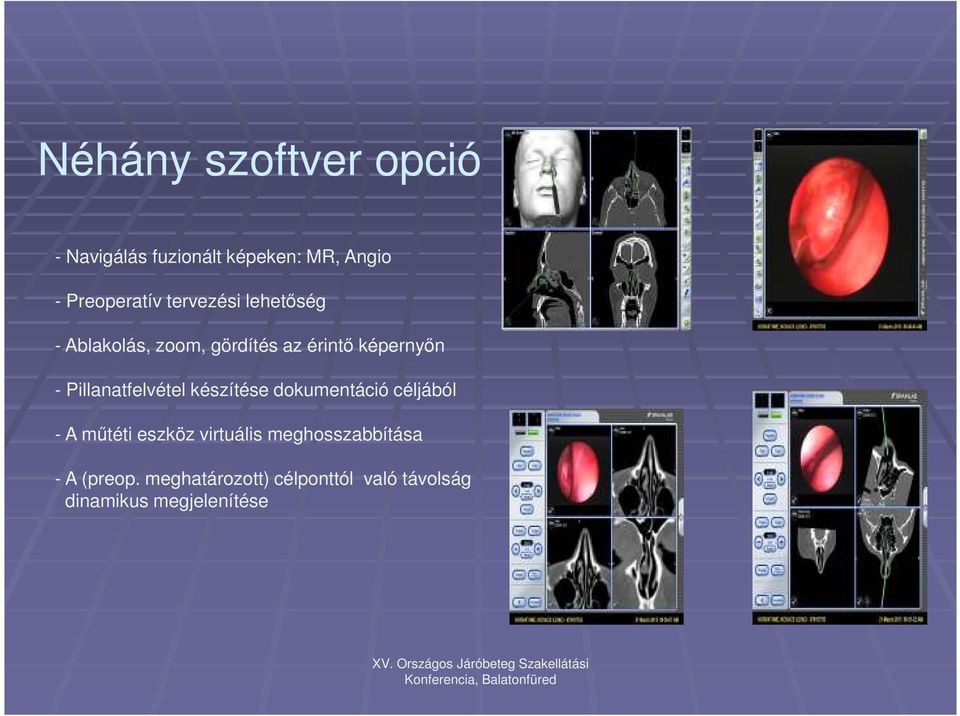 Pillanatfelvétel készítése dokumentáció céljából - A műtéti eszköz virtuális