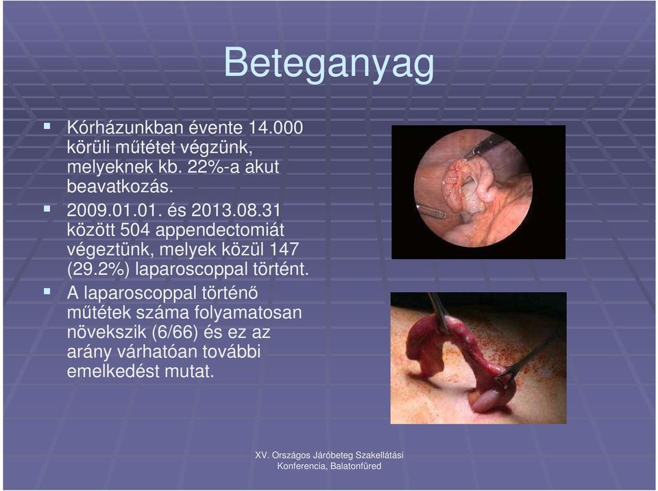 31 között 504 appendectomiát végeztünk, melyek közül 147 (29.