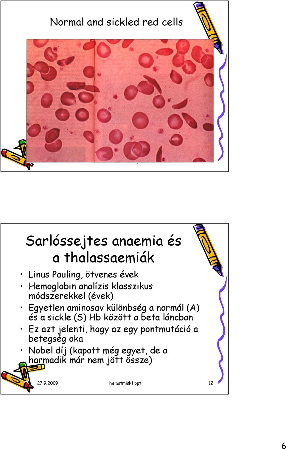 klasszikus módszerekkel (évek) Egyetlen aminosav különbség a normál (A) és a sickle (S) Hb között a