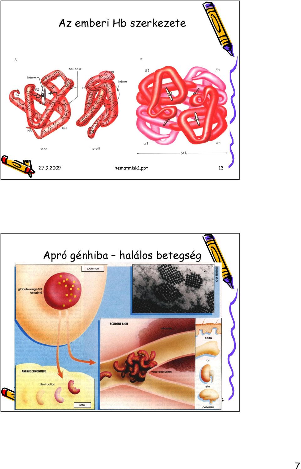 ppt 13 Apró génhiba halálos