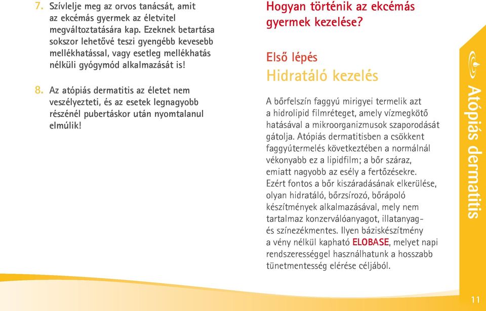 Az atópiás dermatitis az életet nem veszélyezteti, és az esetek legnagyobb részénél pubertáskor után nyomtalanul elmúlik! Hogyan történik az ekcémás gyermek kezelése?