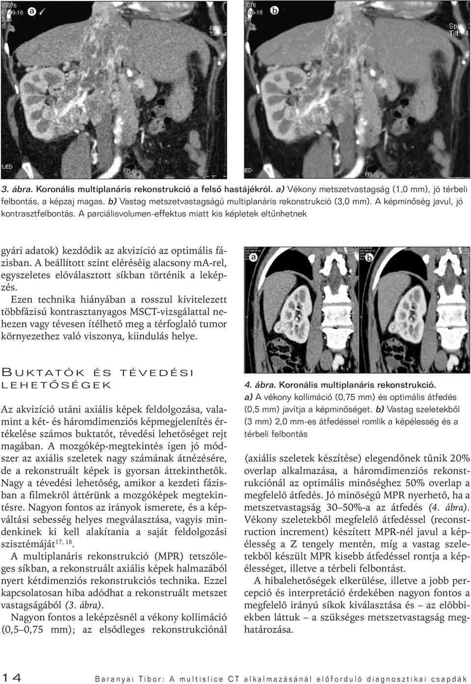 A parciálisvolumen-effektus miatt kis képletek eltûnhetnek gyári adatok) kezdôdik az akvizíció az optimális fázisban.