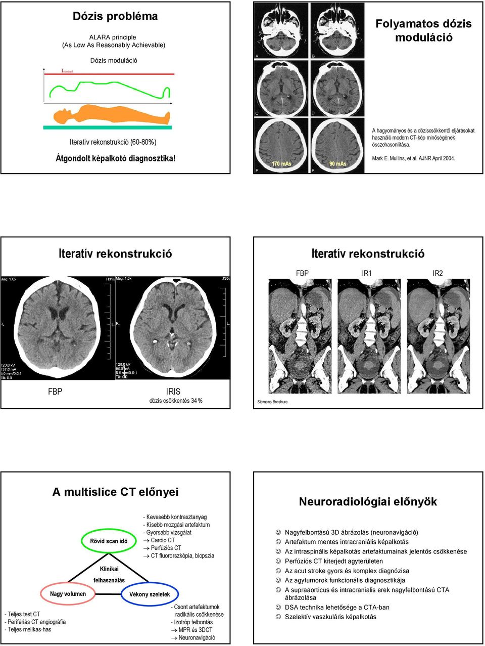 Iteratív rekonstrukció Iteratív rekonstrukció FBP IR1 IR2 FBP IRIS dózis csökkentés 34 % Siemens Broshure A multislice CT előnyei Neuroradiológiai előnyök - Teljes test CT - Perifériás CT angiográfia