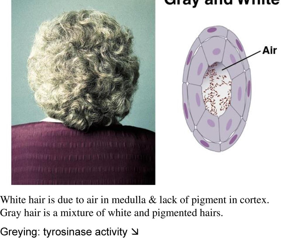 Gray hair is a mixture of white and