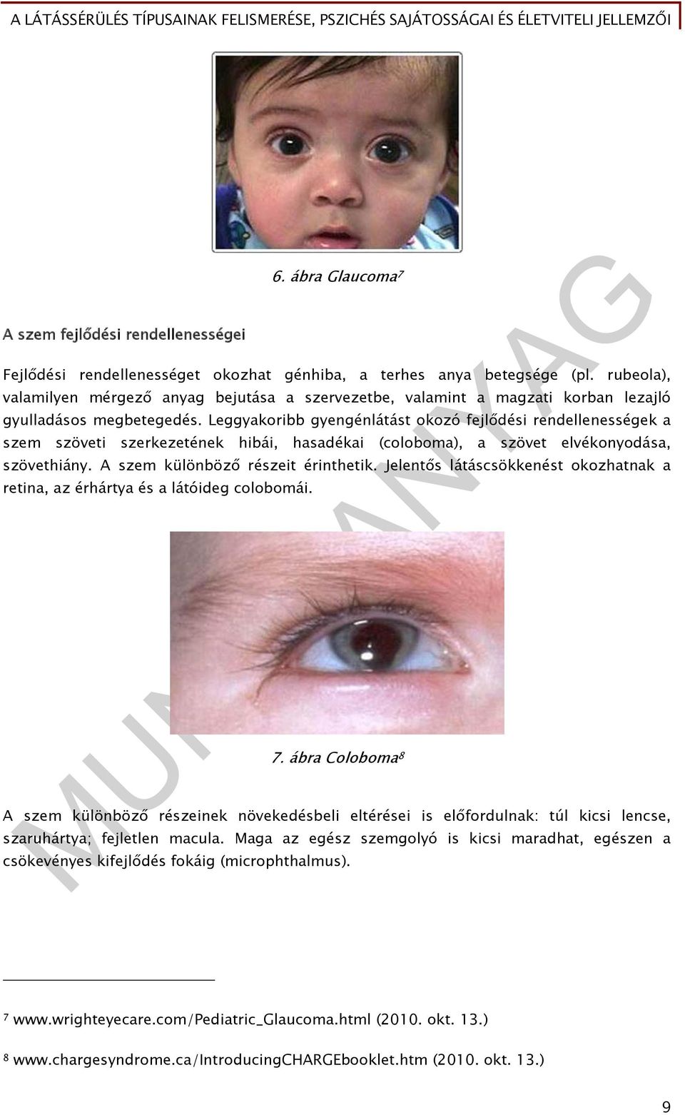 Leggyakoribb gyengénlátást okozó fejlődési rendellenességek a szem szöveti szerkezetének hibái, hasadékai (coloboma), a szövet elvékonyodása, szövethiány. A szem különböző részeit érinthetik.