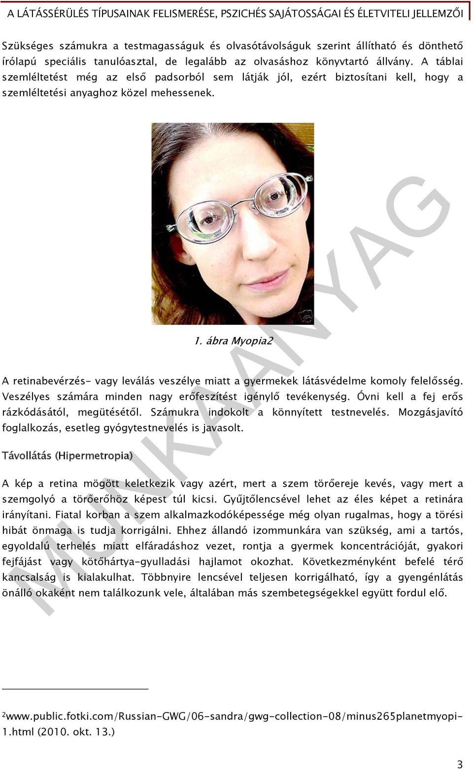 ábra Myopia2 A retinabevérzés- vagy leválás veszélye miatt a gyermekek látásvédelme komoly felelősség. Veszélyes számára minden nagy erőfeszítést igénylő tevékenység.