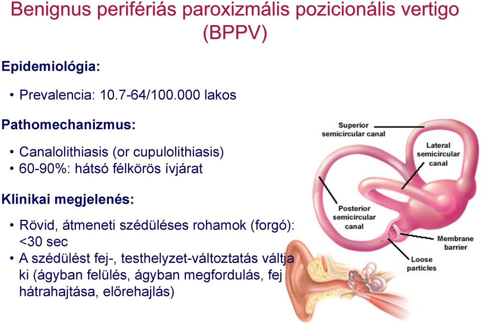 félkörös ívjárat Klinikai megjelenés: Rövid, átmeneti szédüléses rohamok (forgó):