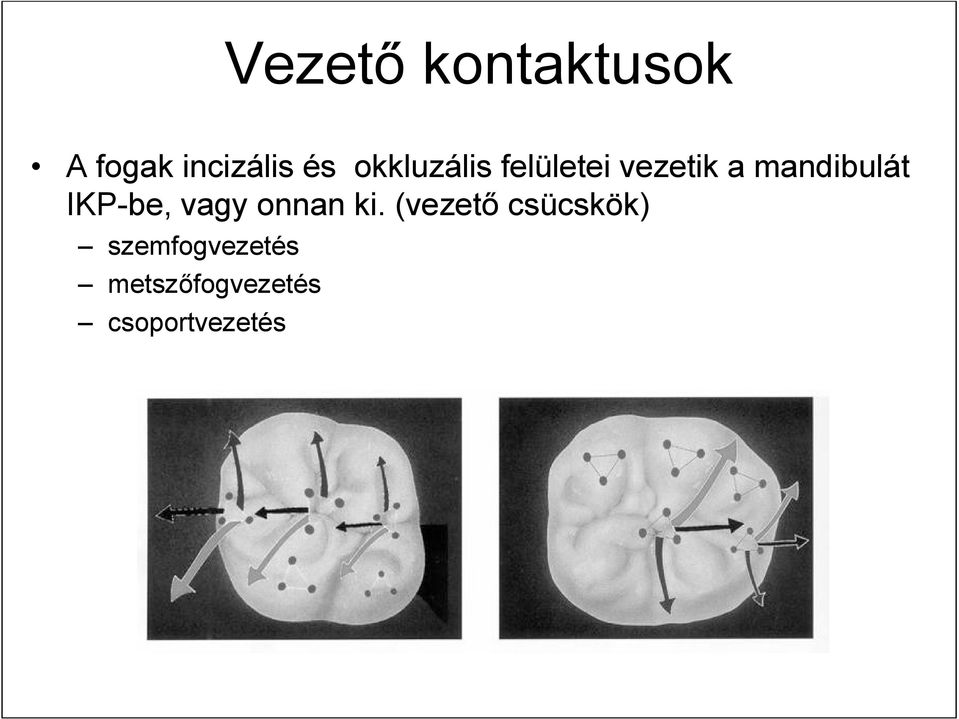 IKP-be, vagy onnan ki.